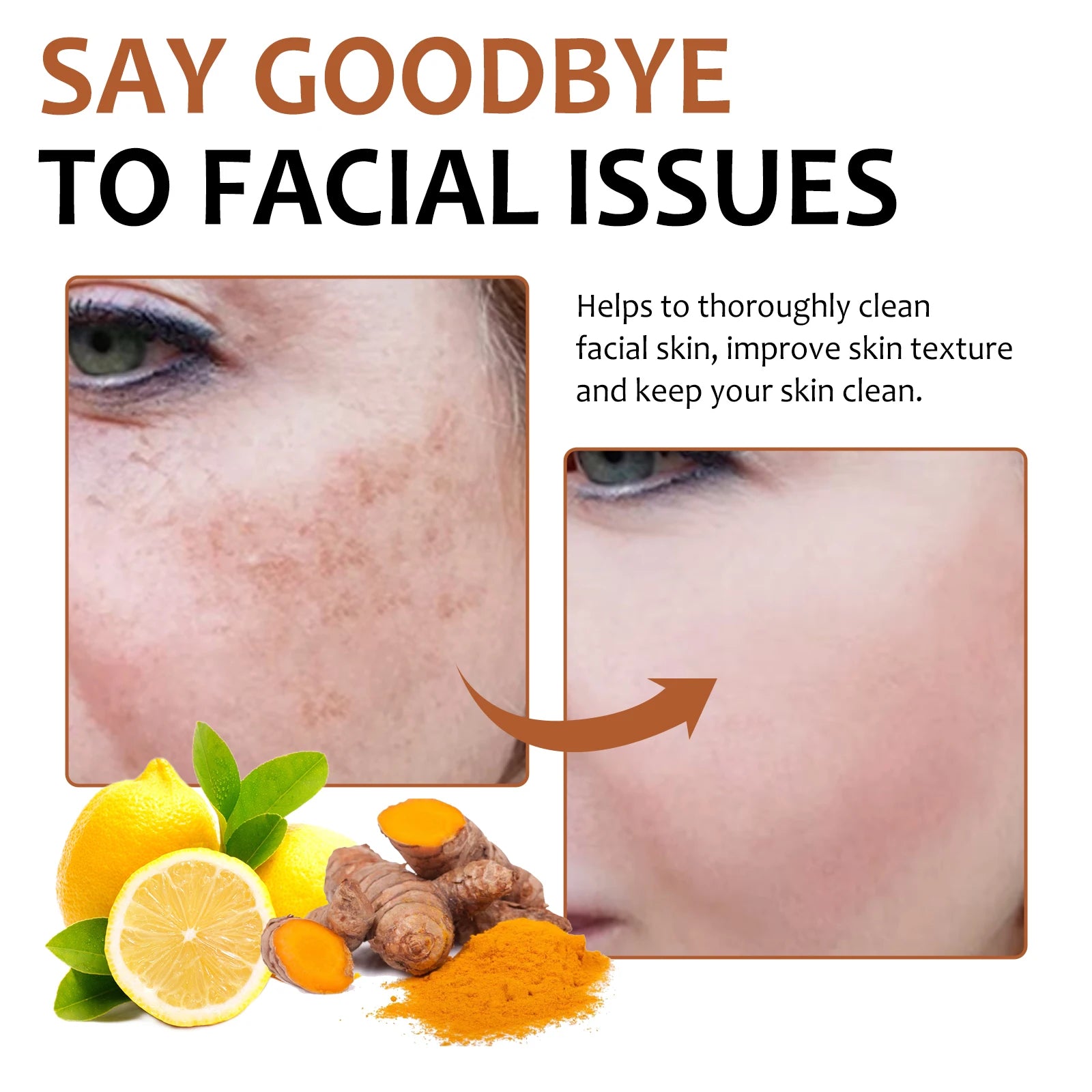 Facial Cleaning Handmade Soap Lemon Turmeric Kojic Acid Soap Deeply Cleansing Exfoliating Even Skin Tone Bathing Soap Skincare