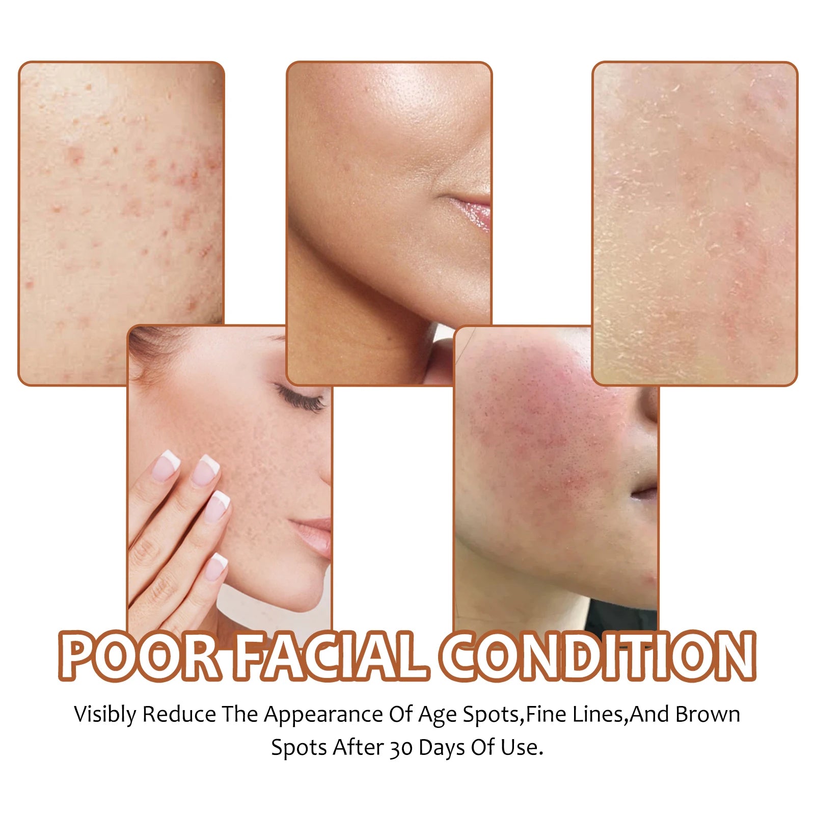 Facial Cleaning Handmade Soap Lemon Turmeric Kojic Acid Soap Deeply Cleansing Exfoliating Even Skin Tone Bathing Soap Skincare